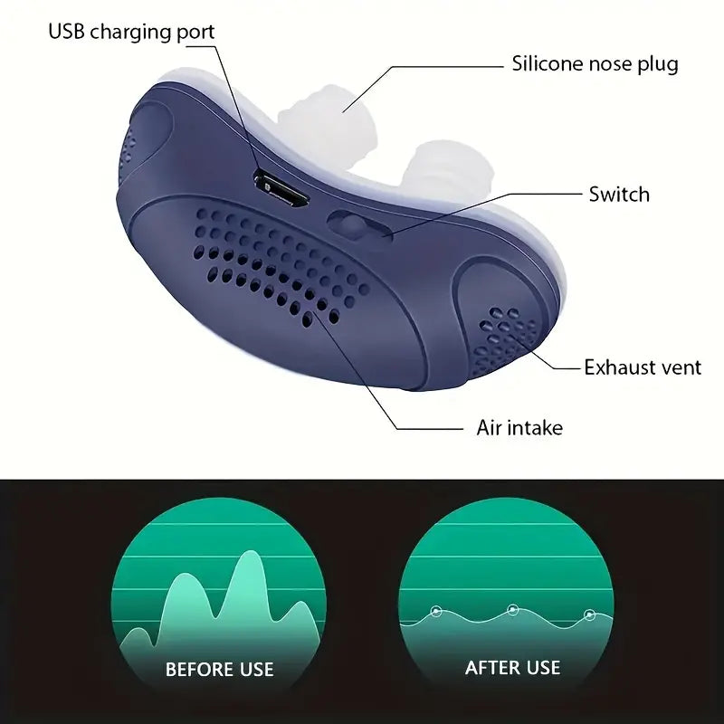 Anti Snoring Device That Works: Sleep Apnea Aid, Smart Nora Solution